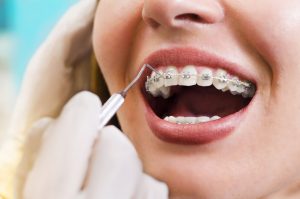 Aperfeiçoamento em Ortodontia (SALVADOR) - Turma II